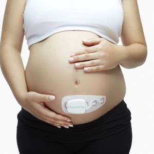 Bloomlife contraction tracker