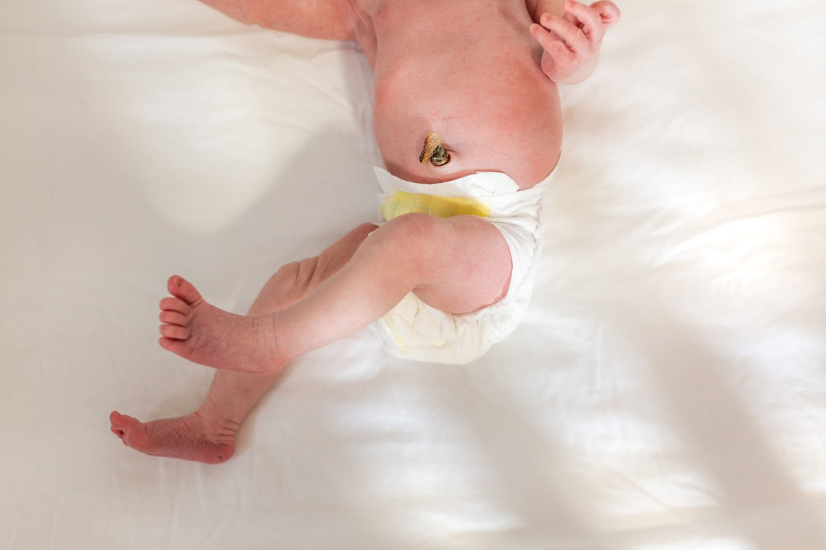 What Happens to Baby's Umbilical Cord After Birth? - Pregnancy