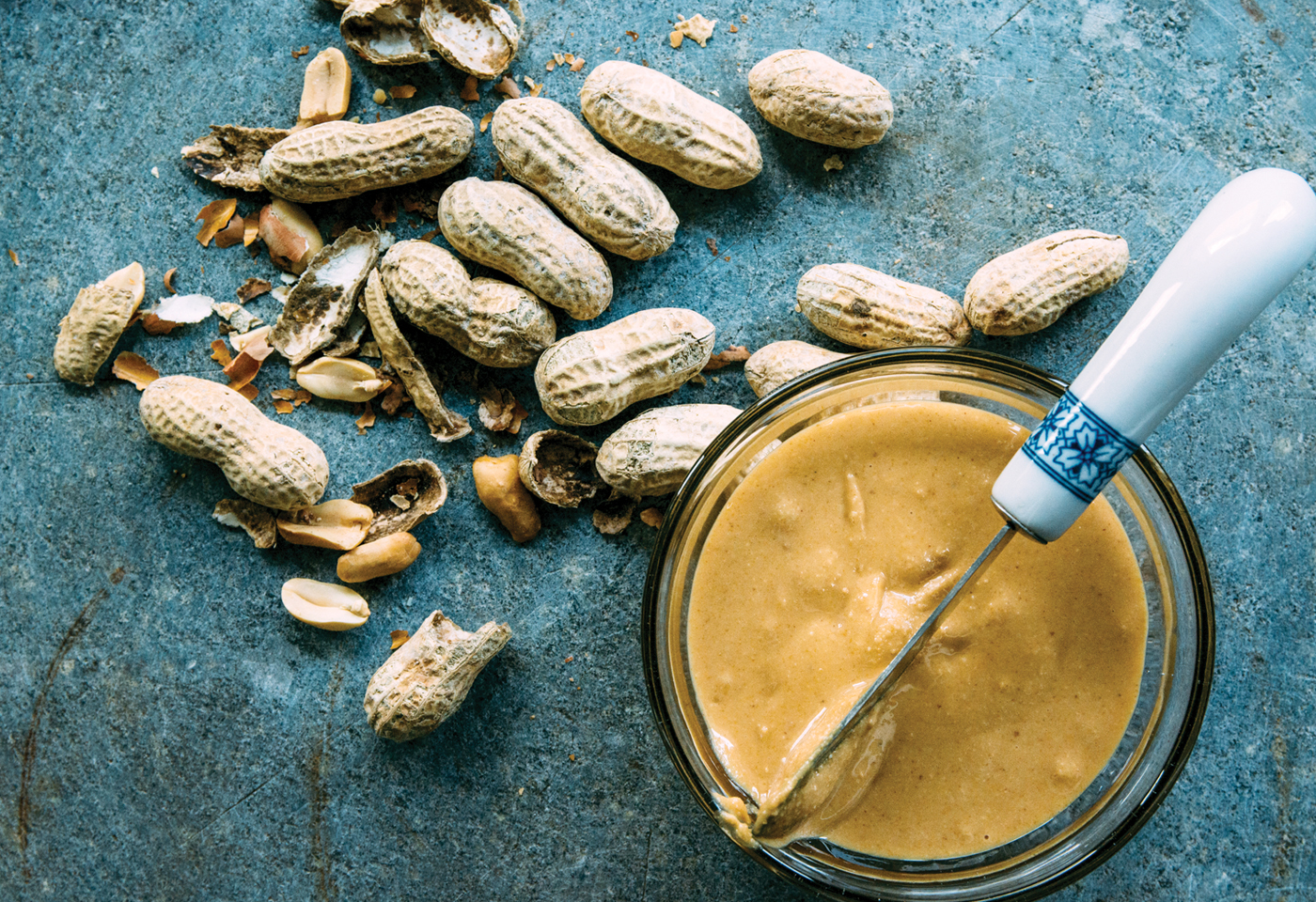 Experts-FoodAllergies Ask the Experts: Baby food allergies, Pregnancy & Newborn