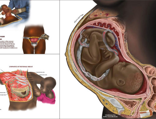 Why aren’t people of color in medical illustrations?